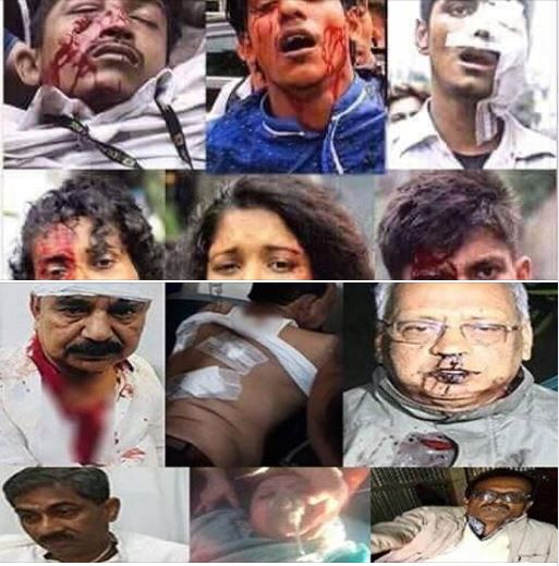 Civilian coup d’état : Sheikh Hasina’s creeping authoritarianism is likely to resume and intensify -William B Milam